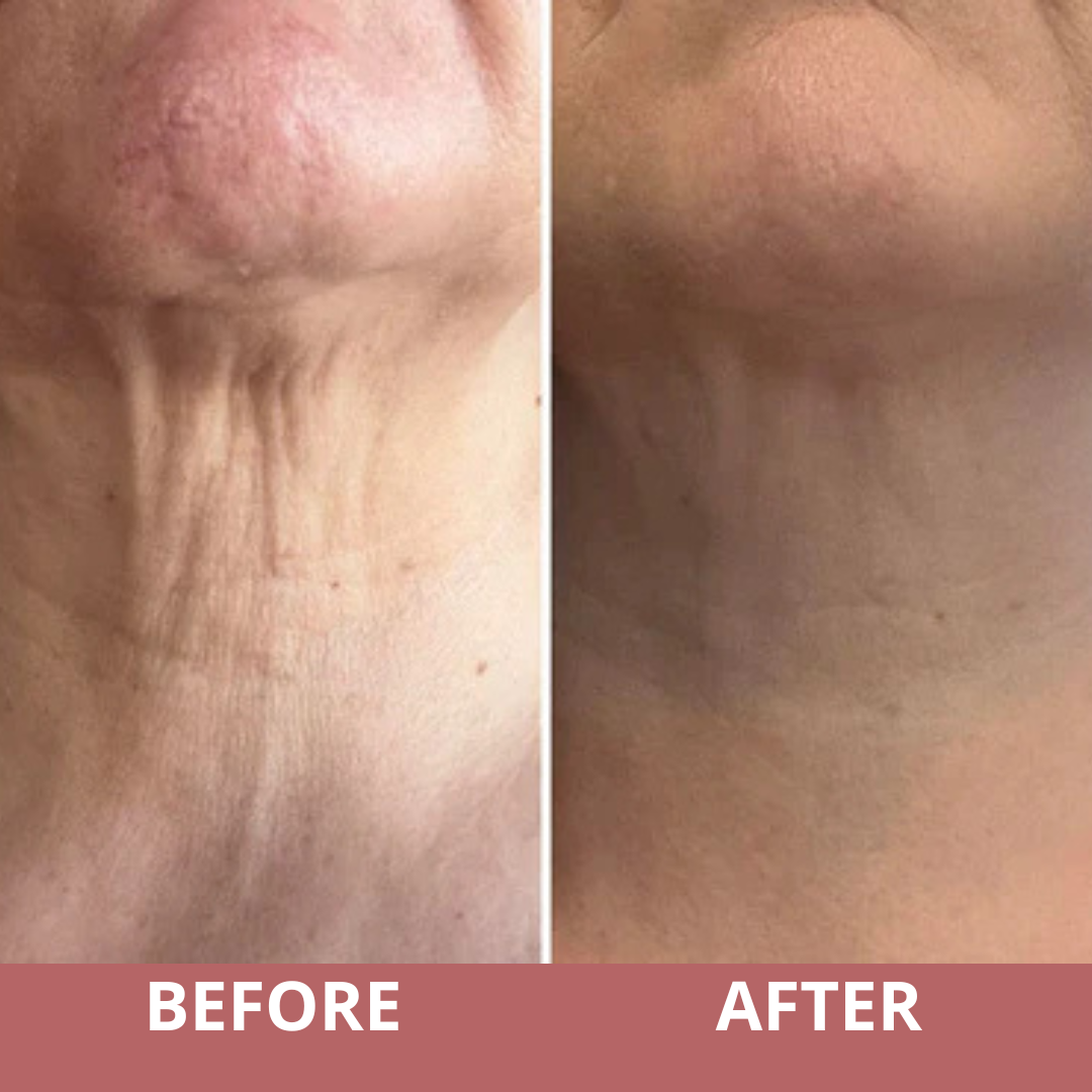 Nova Chic | Liftende nek creme